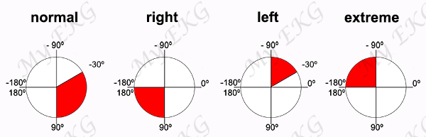 Normal Heart Axis and Deviations